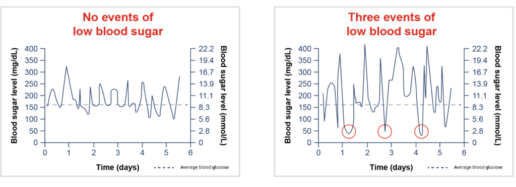 1 of 2 graphs showing the blood sugar level of a person with A1C of 8.0% over a number of days - this graph shows no event of high or low blood sugar. 2 of 2 graphs showing the blood sugar level of a person with A1C of 8.0% over a number of days - this graph shows several events of high and low blood sugar